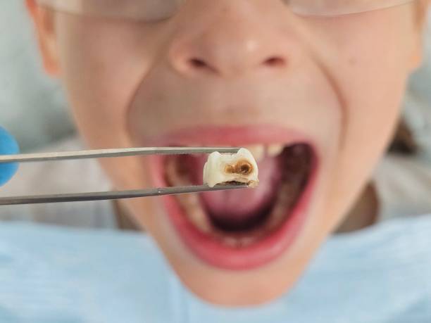 Best Emergency Root Canal Therapy in South Rockwood, MI
